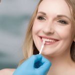 can dental veneers fix overlapping teeth a cosmetic solution
