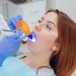 fluoride treatment